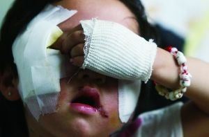 7月13日下午,北京5岁女童被藏獒扑倒咬坏脸(资料图)